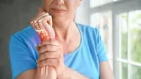 How to prevent osteoporosis after menopause 