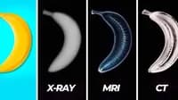 what is the difference between xray mri and ct scan